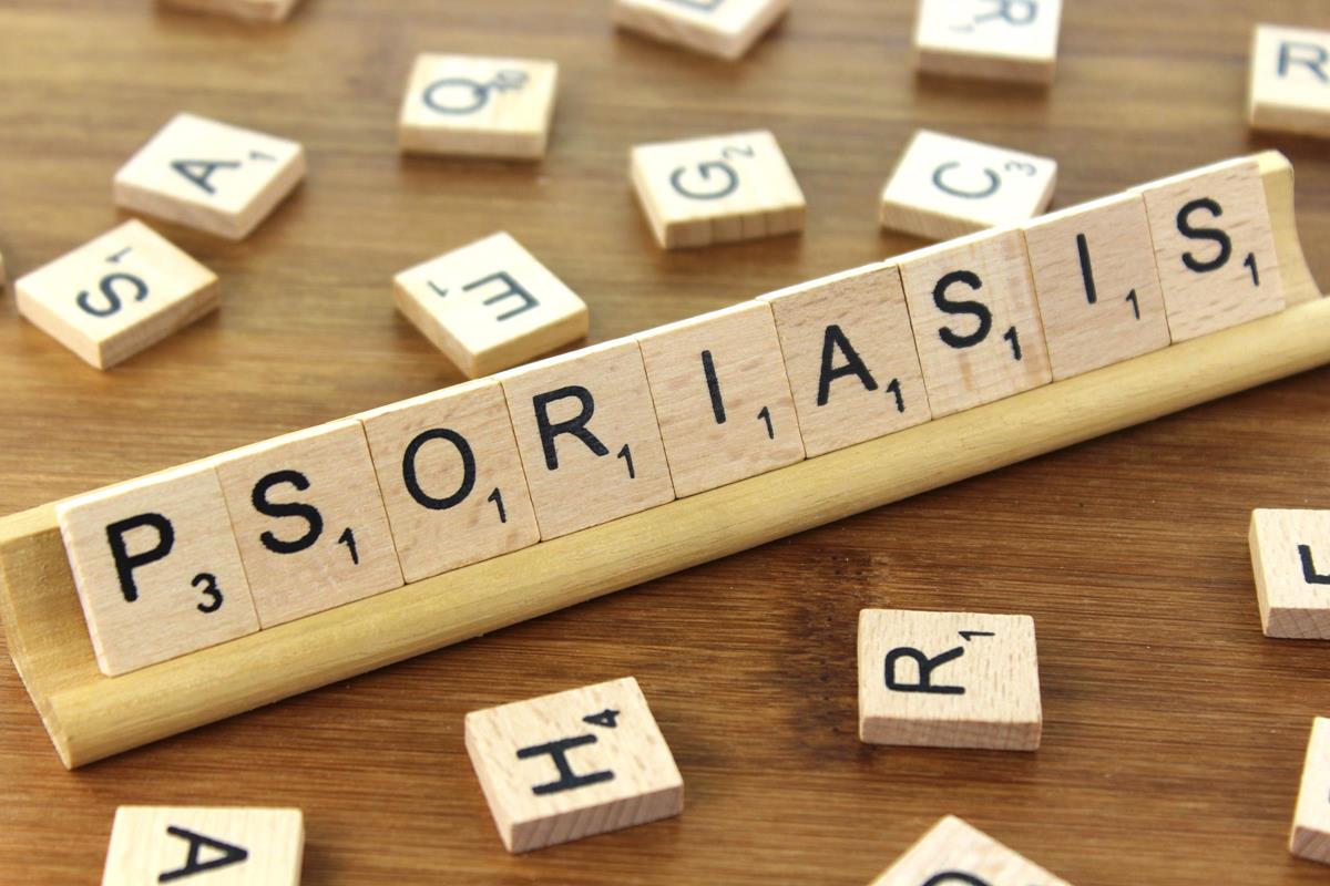 Psoriazis: simptome, cauze si tratamente